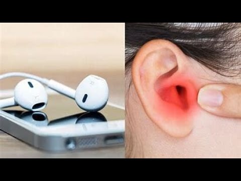 Doctors Warn Against Excessive Use Of Earpieces: May Cause ‘Tinnitus’