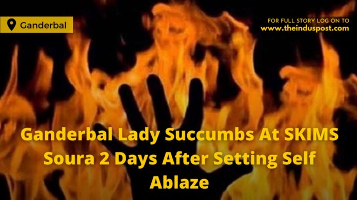 Ganderbal Lady Succumbs At SKIMS Soura 2 Days After Setting Self Ablaze